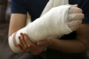 arm in cast