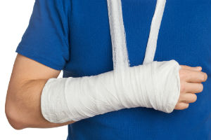 man in blue shirt with broken arm